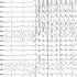 Epilepszia EEG-görbe