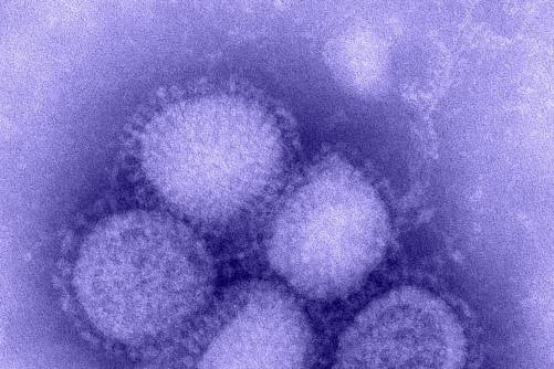 Influenza vírus elektronmikroszkópos képe