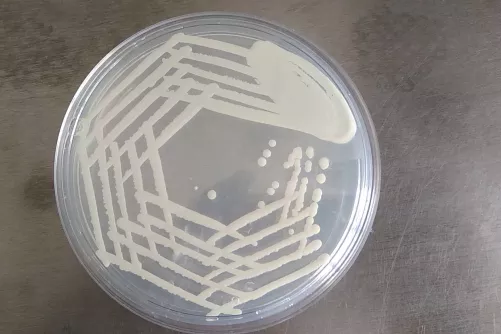Candida telepek Petri-csésze táptalaján