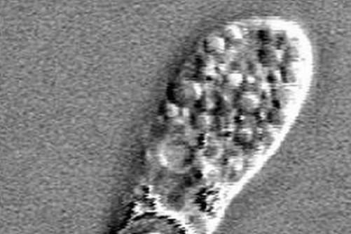 A kórokozó amőba mikroszkópos képen