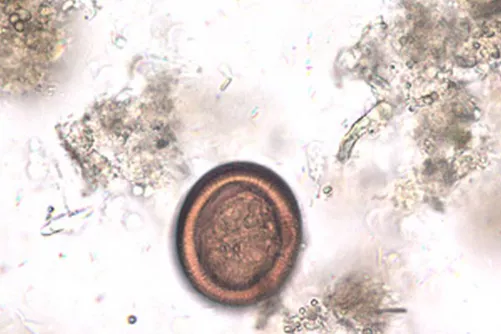 Echinococcus pete mikroszkópos képen.