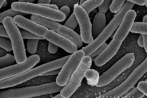 Bélbaktériumok elektronmikroszkóp alatt.