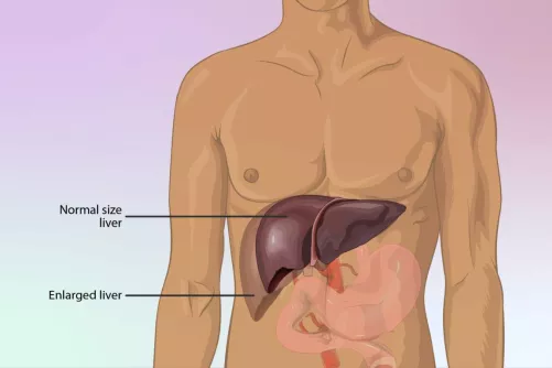 A máj elhelyezkedése (rajz)