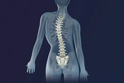 Gerincferdülés számítógépes illusztrációja