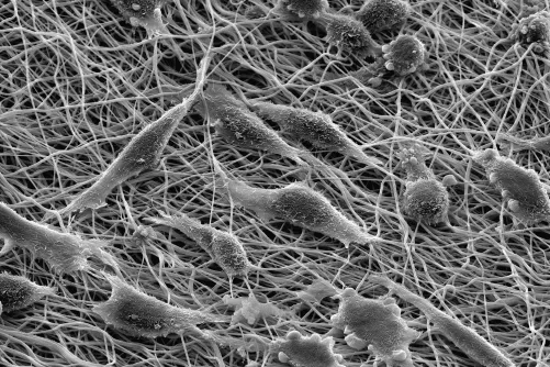 Fibroblasztok elektronmikroszkóp alatt