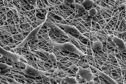 Fibroblasztok elektronmikroszkóp alatt