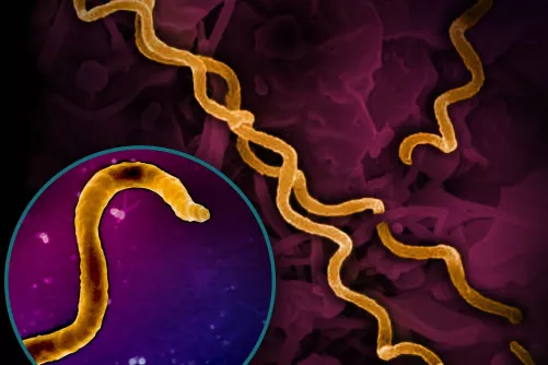 Elektronmikroszkópos kép a szifilisz kórokozójáról