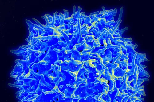 T-sejt elektronmikroszkópos képe