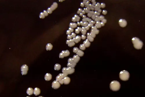 Szamárköhögést okozó baktérium telepei táptalajon