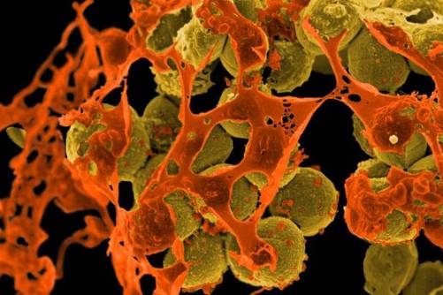 MRSA baktérium elektronmikroszkóp alatt