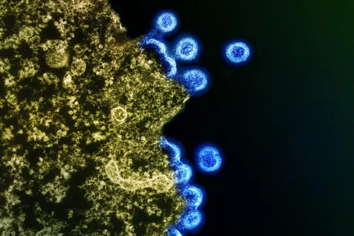 HIV-1 vírusrészecskék T-sejt felületén