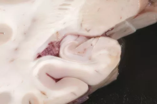 Hippocampus agyi metszeten