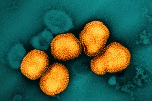 H3N2 influenzavírus elektronmikroszkópos képen