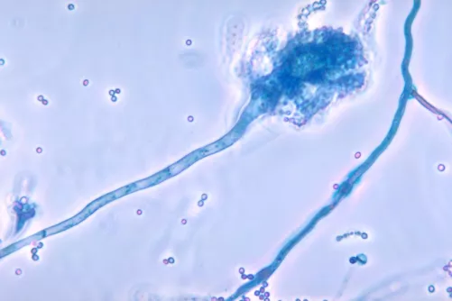Aspergillus fumigatus gomba mikroszkóp alatt