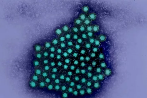 Hepatitis A vírus, színezett elektronmikroszkópos kép