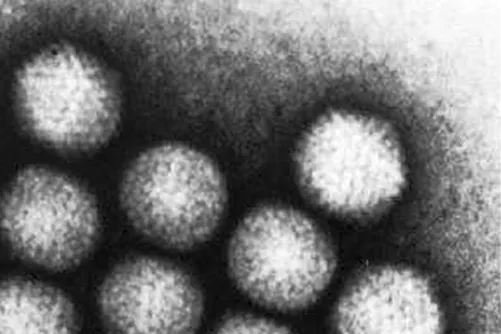 Adenovírusok elektronmikroszkópos képe