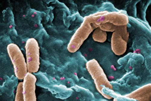 Pseudomonas aeruginosa elektronmikroszkópos képe