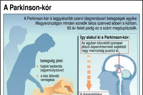 Display a Parkinson-kórról