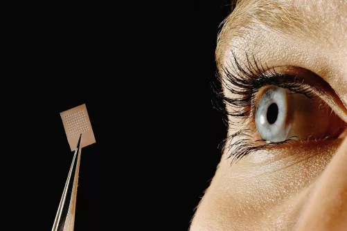 Implantátum a látás visszaállításához (illusztráció)