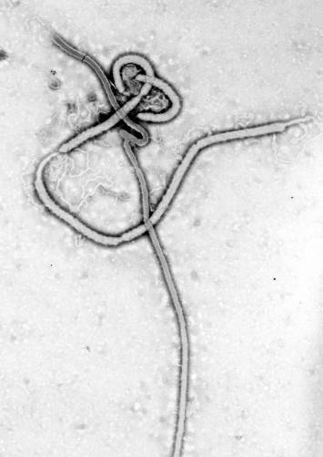 Ebola RNS vírus