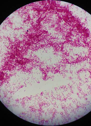 Tejsavbaktériumok mikroszkópos képe