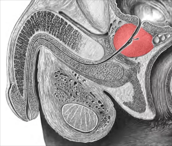Prosztata a kismedencében (metszet)