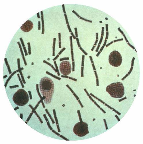 Bacillus anthracis mikroszkóp alatt