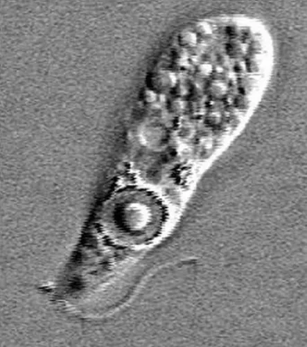 A kórokozó amőba mikroszkópos képen