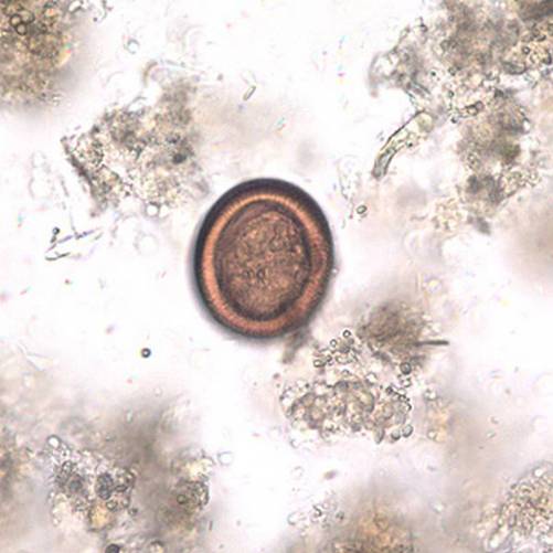 Echinococcus pete mikroszkópos képen.