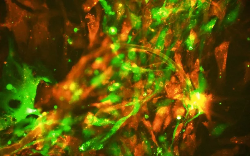 Érképződés (angiogenezis)