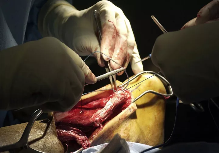 Elszakadt Achilles-ín műtéte