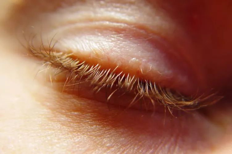 Csukott szem; szemhéj, szempillák