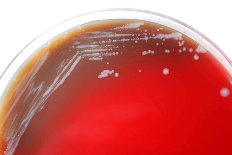Baktériumtenyészet Petri-csészében