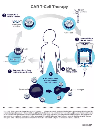 CAR-T infografika