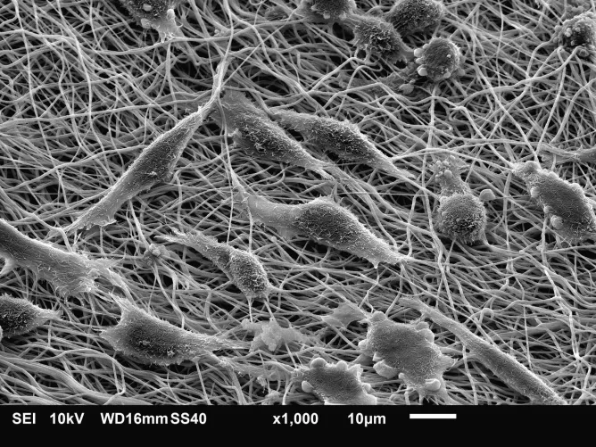 Fibroblasztok elektronmikroszkóp alatt