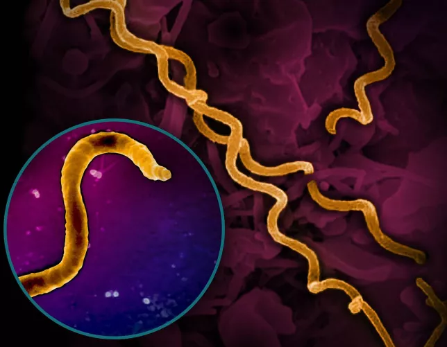 Elektronmikroszkópos kép a szifilisz kórokozójáról