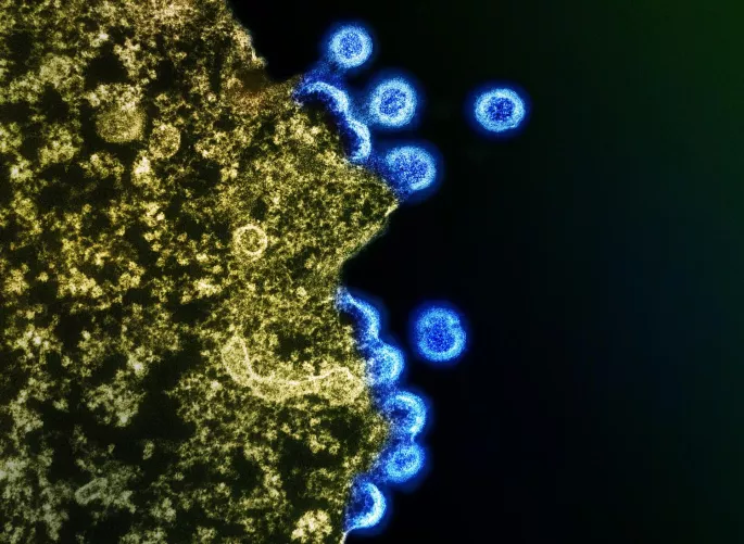 HIV-1 vírusrészecskék T-sejt felületén