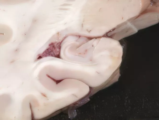 Hippocampus agyi metszeten