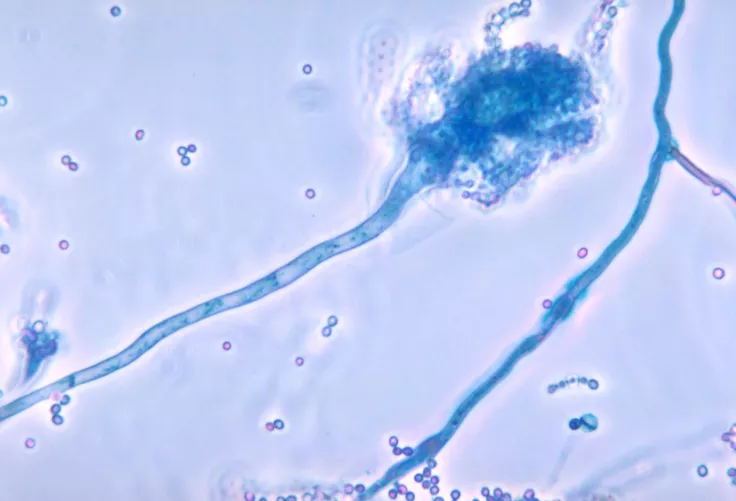 Aspergillus fumigatus gomba mikroszkóp alatt