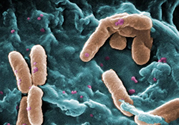Pseudomonas aeruginosa elektronmikroszkópos képe