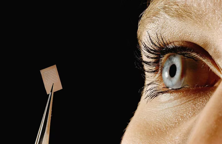 Implantátum a látás visszaállításához (illusztráció)