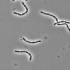 Pálcika alakú Lactobacillus rhamnosus