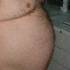 Férfi típusos abdominális, (hasi) elhízása.