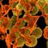 MRSA baktérium elektronmikroszkóp alatt