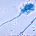 Aspergillus fumigatus gomba mikroszkóp alatt
