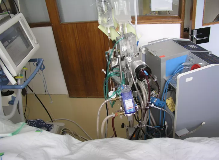 ECMO-eszköz