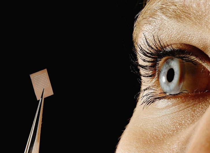 Implantátum a látás visszaállításához (illusztráció)