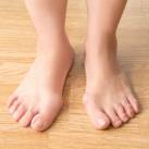 Bütyök (Hallux valgus) Hallux valgus, azaz "bütyök"