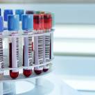 Kémcsövek centrifugában