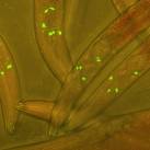 Fonalféregbe juttatott fluoreszkáló protein